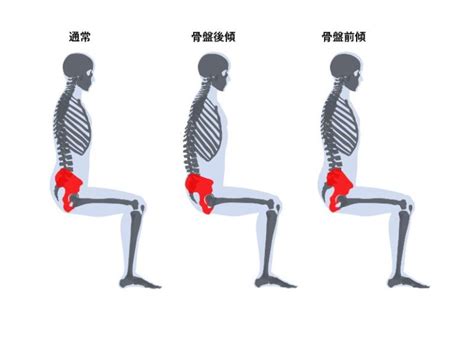 後面座位|「骨盤の前傾・後傾をつくる要因と、それにより起こ。